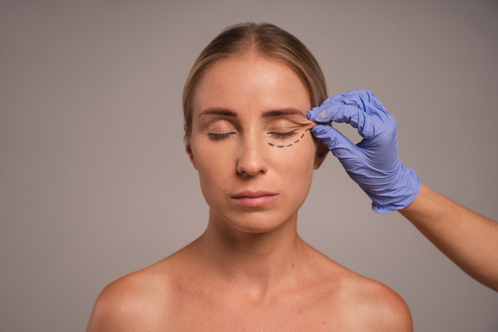 Blefaroplastia em cuiaba